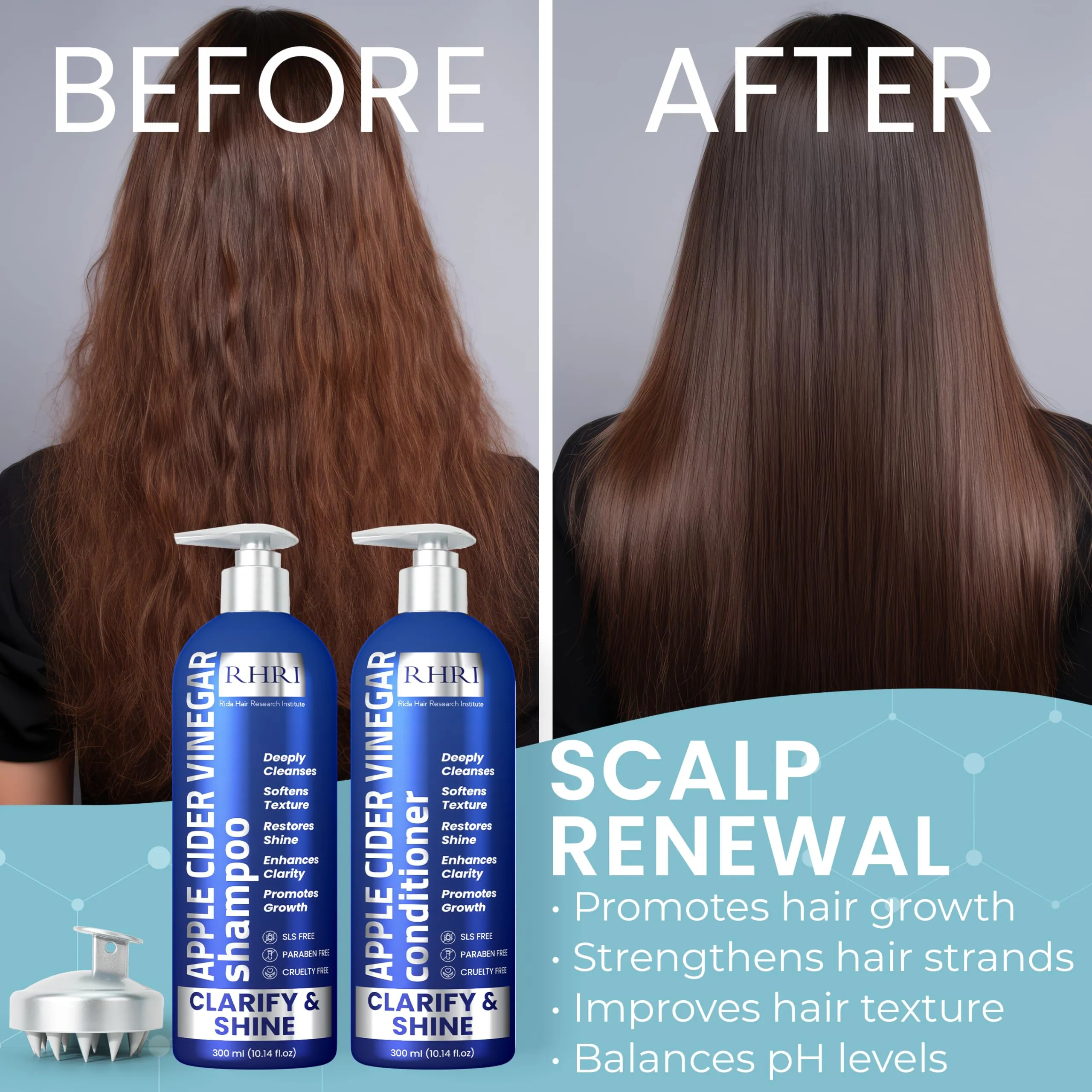Apple Cider Vinegar Shampoo and Conditioner Set | Deep Cleansing, Frizz Control, Shine Restoration & Scalp Care | Clarifying Shampoo for All Hair Types | 10.14 fl.oz (Pack of 2)