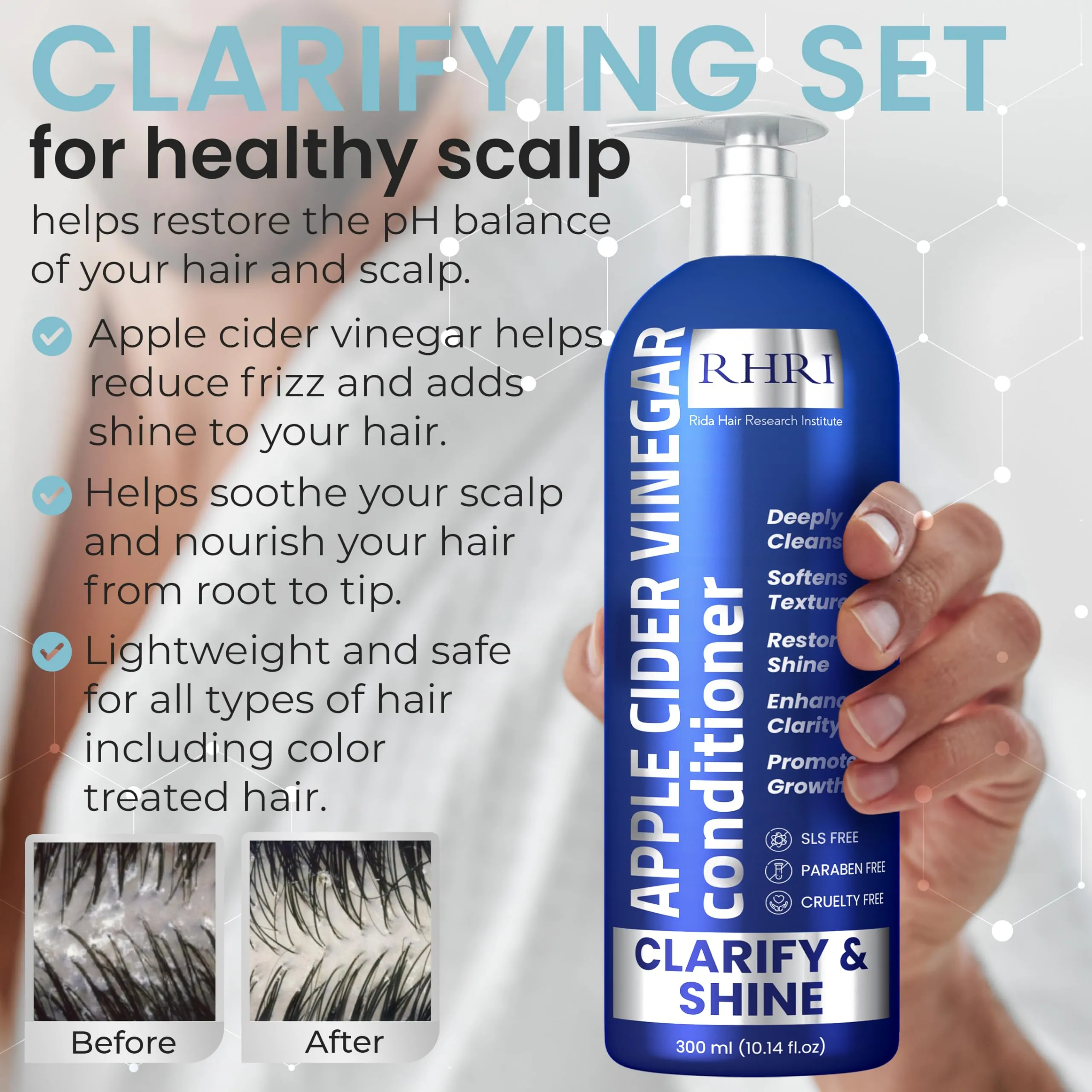 Apple Cider Vinegar Shampoo and Conditioner Set | Deep Cleansing, Frizz Control, Shine Restoration & Scalp Care | Clarifying Shampoo for All Hair Types | 10.14 fl.oz (Pack of 2)