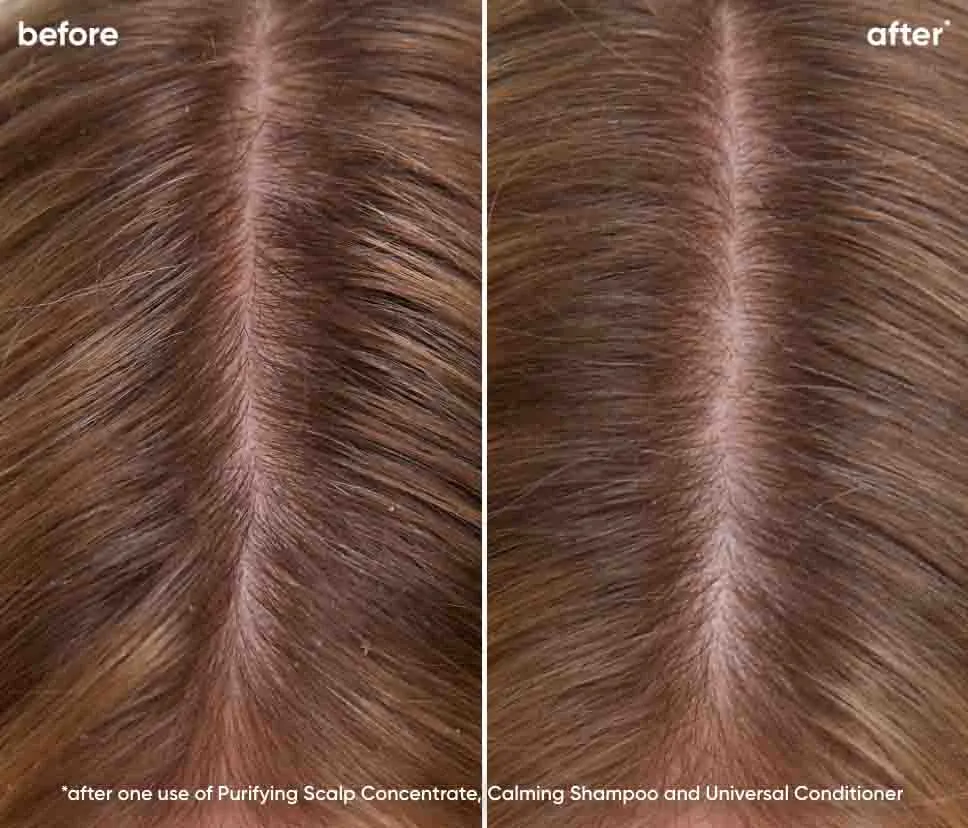 Biolage Scalp Sync Universal Conditioner 280ml